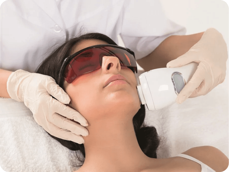 Rejuvenation treatment with derma roller